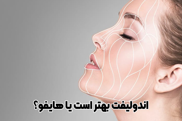 اندولیفت بهتر است یا هایفو؟ بررسی جامع صفرتاصد!