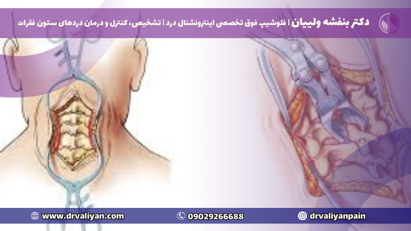 جراح دیسک گردن در تهران