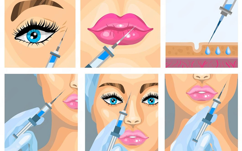 فیلر چیست و چه کاربردی دارد ؟