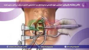 بهترین جراح دیسک گردن در تهران