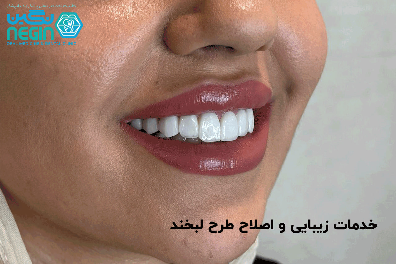 خدمات زیبایی و اصلاح طرح لبخند