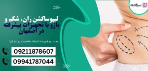 لیپوساکشن در اصفهان
