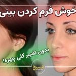 همه از بینی طبیعی‌شون راضی نیستن، اما همه هم به جراحی با بیهوشی نیاز ندارن!