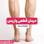 درمان واریس