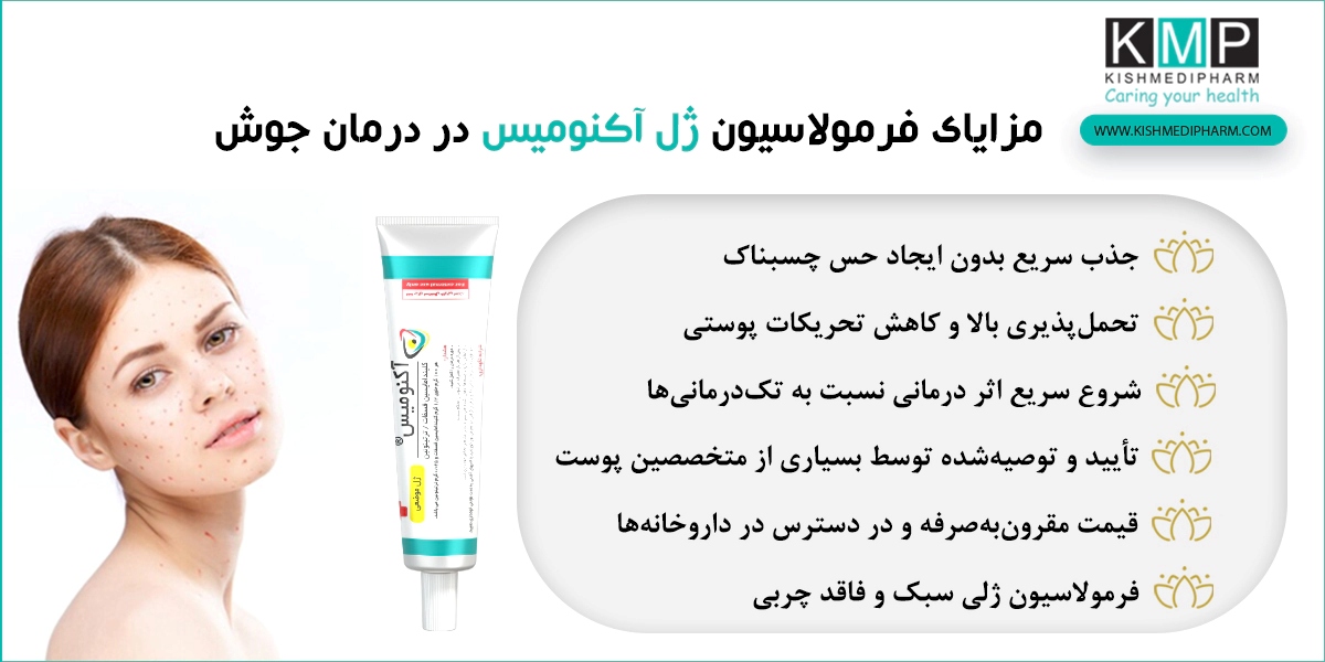 مزیت و مزایای ژل موضعی ضد جوش آکنومیس