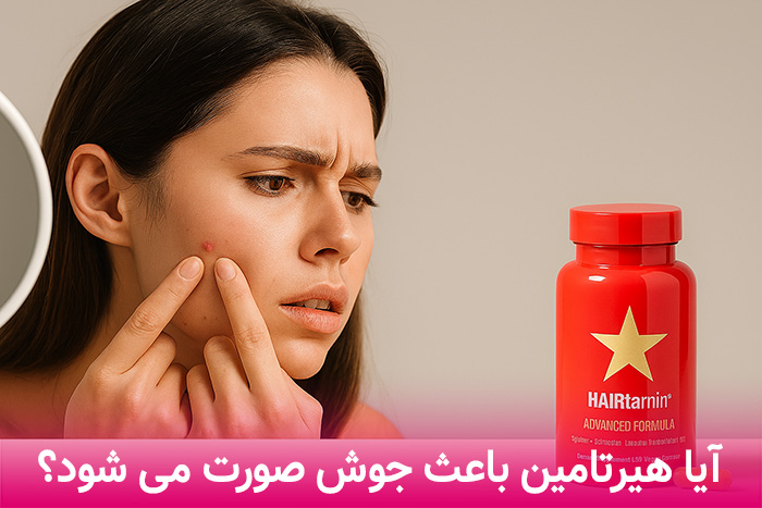آیا قرص هیرتامین باعث جوش صورت می شود؟