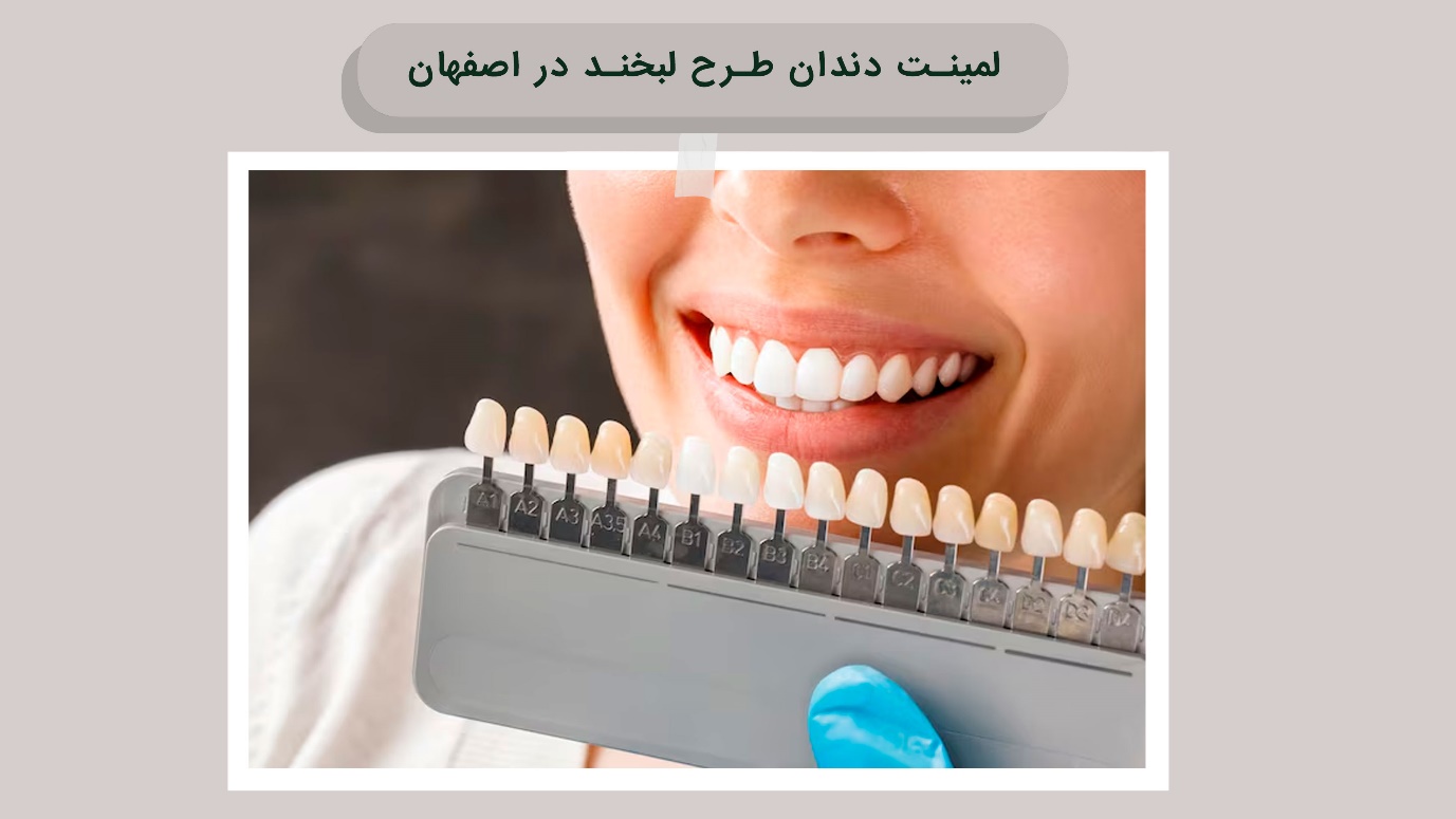 لمینت دندان طرح لبخند در اصفهان لمینت دندان اصفهان با دکتر باقریان نژاد