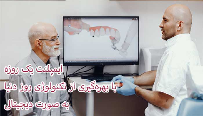 ایمپلنت فوری یک روزه دیجیتالی چیست؟ ایمپلنت دیجیتالی فوری چگونه است؟