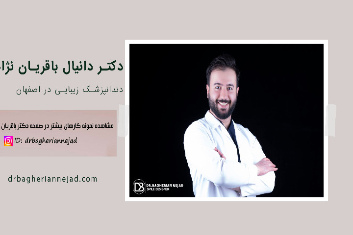 لمینت دندان طرح لبخند در اصفهان