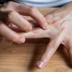 علل خارش انگشتان دست و راه‌های تشخیص و درمان آن