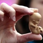 عوارض سقط‌های غیرقانونی بسیار گسترده و خطرناک است