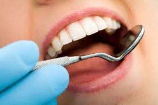 معاینه دندان تا ۷سالگی کودک را از ارتودنسی و جراحی آینده نجات می‌دهد