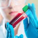 چقدر احتمال دارد مبتلا به سرطان شویم