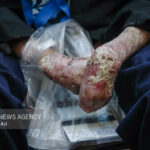 ارسال ۱۰۰۰ دارو و ۹۷۰ پانسمان بیماران پروانه ای