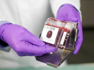 ذخیره سازی ۱۵۰۰ نمونه خون بندناف در جنگ رمضان