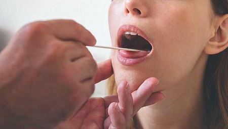 زائده های زیر زبان, برجستگی های زیر زبان, علت به وجود آمدن زائده زیر زبان