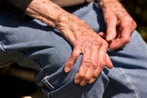 مشکل هورمون درمانی برای بیماران جراحی مفصل زانو