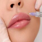 10 نکاتی که قبل از تزریق ژل باید رعایت شود✅