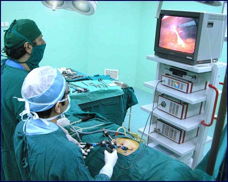 انواع و نحوه انجام جراحی برداشتن کلیه یا نفرکتومی