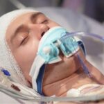 ضربه به سر ممکن است سلامت روده را مختل کند