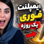 ایمپلنت فوری کلینیک آرامهر
