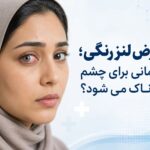 عوارض استفاده از لنز رنگی و ضرر لنز رنگی برای چشم