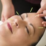 درد میگرن پس از انجام طب سوزنی روی گوش کاهش می یابد!