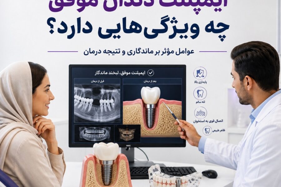 ایمپلنت دندان موفق چه ویژگی‌هایی دارد؟ عوامل موثر بر ماندگاری و نتیجه درمان