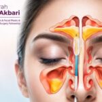 جراحی آندوسکوپی بینی و سینوس