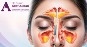 جراحی آندوسکوپی بینی و سینوس