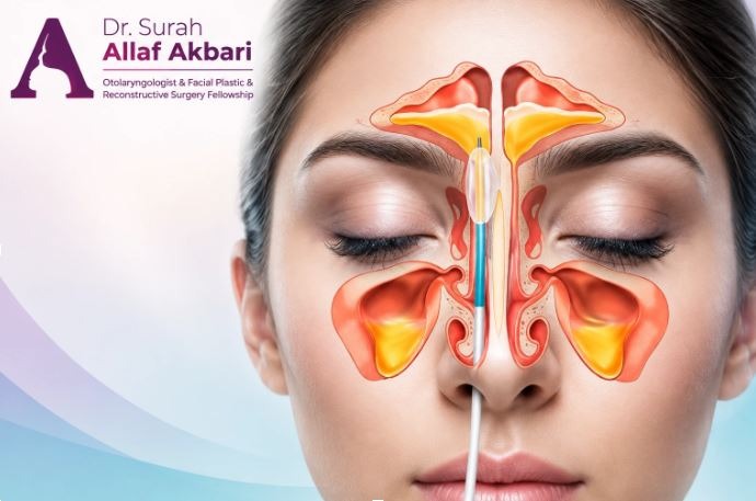 جراحی آندوسکوپی بینی و سینوس؛ درمان قطعی مشکلات تنفسی جراحی آندوسکوپی بینی و سینوس